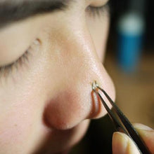 Load image into Gallery viewer, Blackhead and Comedone Acne Extractor